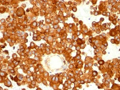 CD63 Monoclonal Mouse Antibody (MX-49.129.5)