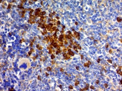 CD63 Monoclonal Mouse Antibody (MX-49.129.5)