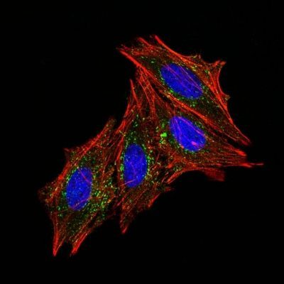 CD63 Monoclonal Mouse Antibody (MX-49.129.5)