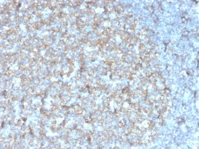 CD81 / TAPA-1 Recombinant Monoclonal Mouse Antibody (rC81/3442)