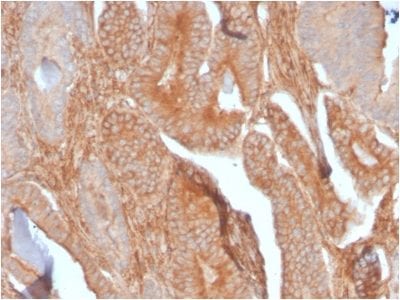 CD81 / TAPA-1 Recombinant Monoclonal Rabbit Antibody (C81/2885R)