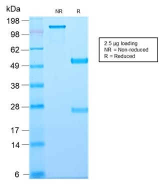 CD81 / TAPA-1 Recombinant Monoclonal Rabbit Antibody (C81/2885R)