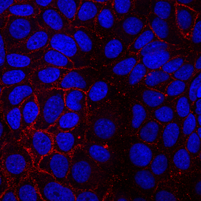 CD81 Monoclonal Mouse Antibody (5A6)