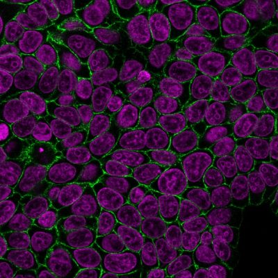 Ep-CAM / CD326 Monoclonal Mouse Antibody (HEA125)