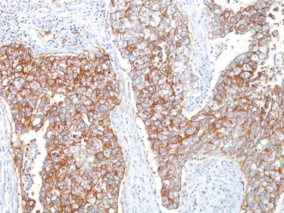 Ep-CAM / CD326 Monoclonal Mouse Antibody (HEA125)