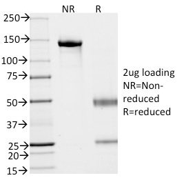 Ep-CAM / CD326 Monoclonal Mouse Antibody (VU-1D9)