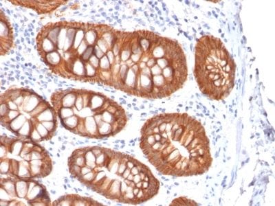 Ep-CAM / CD326 Recombinant Monoclonal Mouse Antibody (rVU-1D9)