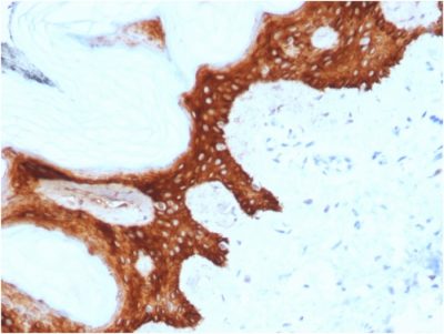14-3-3 Sigma / Stratifin Monoclonal Mouse Antibody (CPTC-SFN-2)