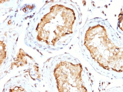 14-3-3E Monoclonal Mouse Antibody (CPTC-YWHAE-1)