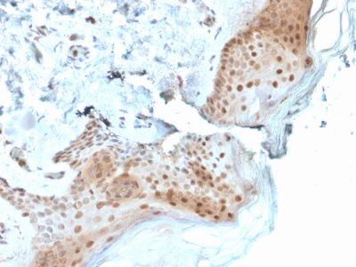 8-Oxoguanine DNA Glycosylase Monoclonal Mouse Antibody (CPTC-OGG1-1)