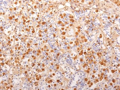 ACTH Monoclonal Mouse Antibody (2F6)