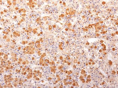 ACTH Monoclonal Mouse Antibody (57)