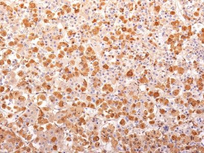 ACTH Monoclonal Mouse Antibody (AH26 + 57)