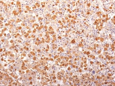 ACTH Recombinant Monoclonal Mouse Antibody (r57)