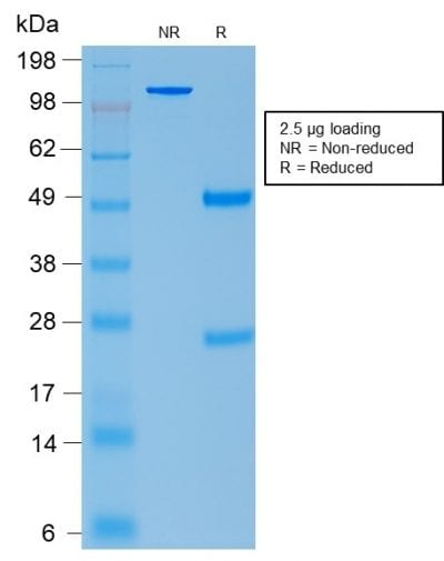 ACTH Recombinant Monoclonal Mouse Antibody (rCLIP/1407)