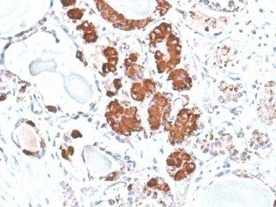 ACTH Recombinant Monoclonal Mouse Antibody (rCLIP/1407)