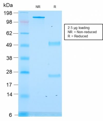 ACTH Recombinant Monoclonal Mouse Antibody (rCLIP/1418)