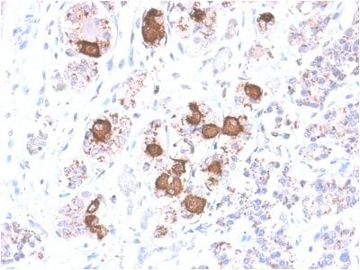 ACTH Recombinant Monoclonal Rabbit Antibody (CLIP/2040R)