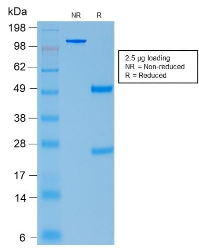 ACTH Recombinant Monoclonal Rabbit Antibody (CLIP/2040R)