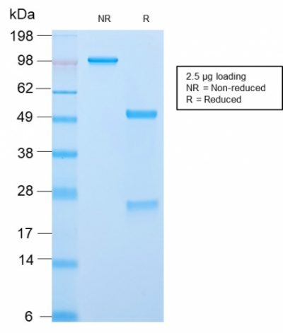ACTH Recombinant Monoclonal Rabbit Antibody (CLIP/2859R)