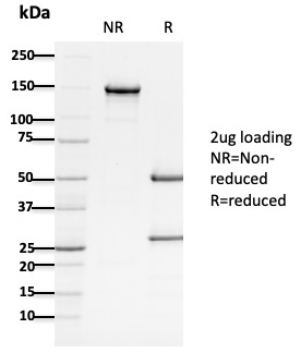 Adenomatous Polyposis Coli / APC Monoclonal Mouse Antibody (ALi 12-28)