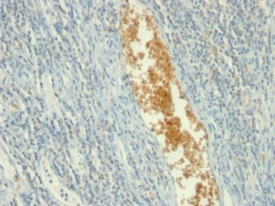 Adenosine Monophosphate Deaminase-3 Monoclonal Mouse Antibody (AMPD3/901)