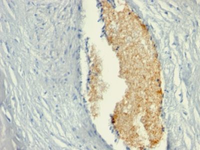Adenosine Monophosphate Deaminase-3 Monoclonal Mouse Antibody (AMPD3/901)
