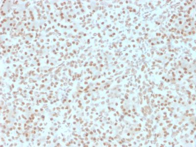 AKT1 Monoclonal Mouse Antibody (AKT1/2491)