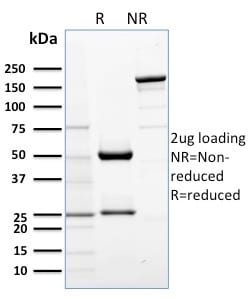 AKT1 Monoclonal Mouse Antibody (AKT1/2552)