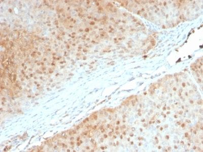 AKT1 Monoclonal Mouse Antibody (AKT1/2552)