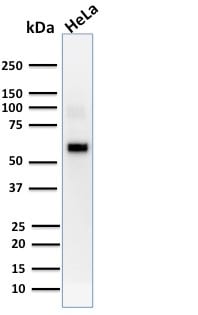AKT1 Monoclonal Mouse Antibody (AKT1/2552)