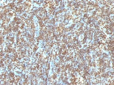 Double-Stranded DNA Monoclonal Mouse Antibody (121-3)
