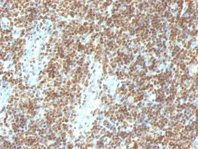 Double-Stranded DNA Monoclonal Mouse Antibody (DSD/958)