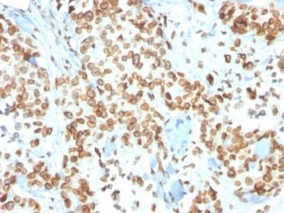 Emerin Monoclonal Mouse Antibody (EMD/2167)