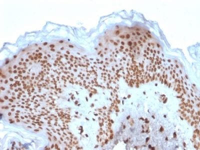 Emerin Monoclonal Mouse Antibody (EMD/2167)
