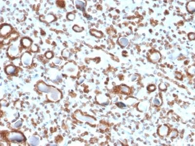 Emerin Monoclonal Mouse Antibody (EMD/2167)