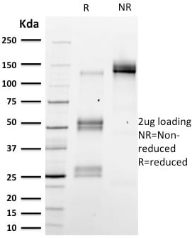 Emerin Monoclonal Mouse Antibody (EMD/2167)