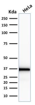 Emerin Monoclonal Mouse Antibody (EMD/2167)