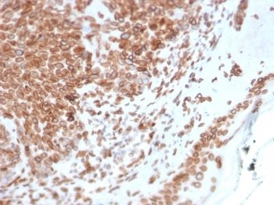 Emerin Monoclonal Mouse Antibody (EMD/2168)