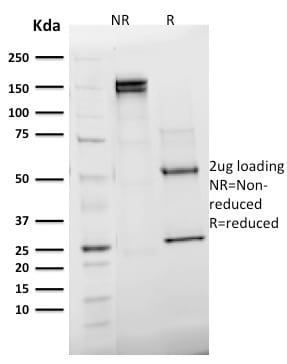 Emerin Monoclonal Mouse Antibody (EMD/2168)