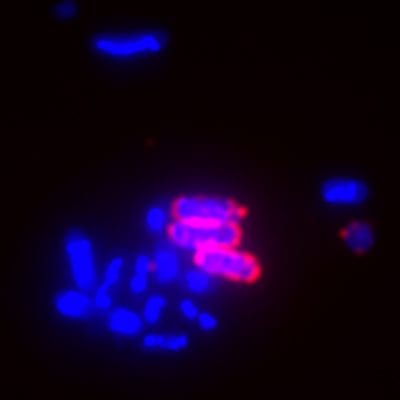 Live Bacterial Gram Stain Kit