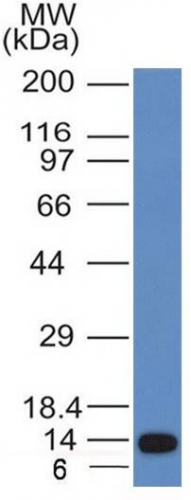 ALK / CD246 Monoclonal Mouse Antibody (ALK/1031)