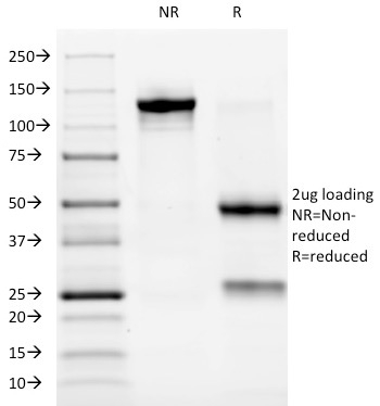ALK / CD246 Monoclonal Mouse Antibody (ALK/1032)