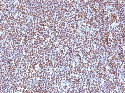 ALK / CD246 Monoclonal Mouse Antibody (ALK/1504)