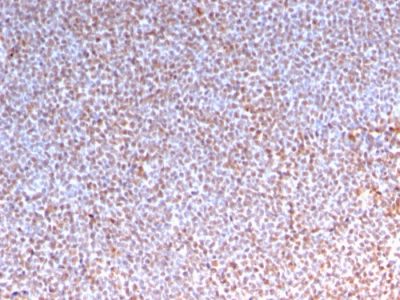 ALK / CD246 Recombinant Monoclonal Rabbit Antibody (ALK/3218R)