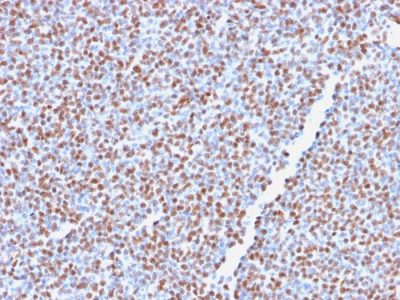 ALK / CD246 Recombinant Monoclonal Rabbit Antibody (ALK1/2766R)