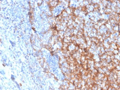 CD11b Monoclonal Mouse Antibody (ITGAM/3337)