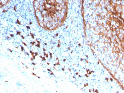 CD11b Monoclonal Mouse Antibody (ITGAM/3339)