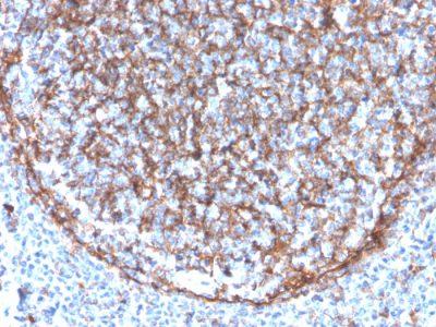 CD11b Monoclonal Mouse Antibody (ITGAM/3340)