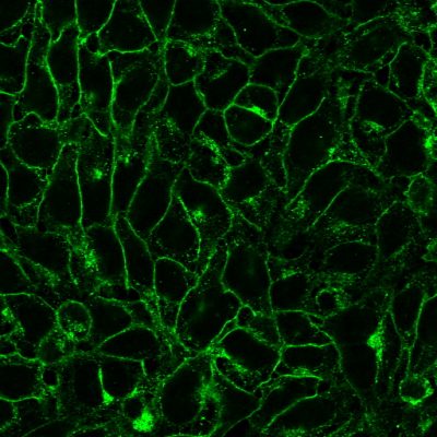 DNP Polyclonal Rabbit Antibody